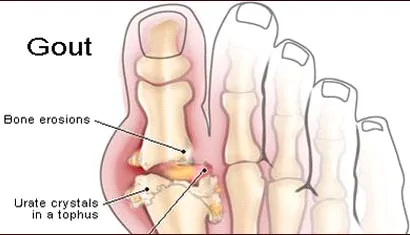 thuoc gout anserine minami nhat ban 1