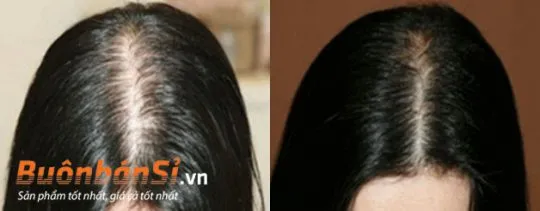 mọc tóc best biotin thay đổi mái tóc mỗi ngày