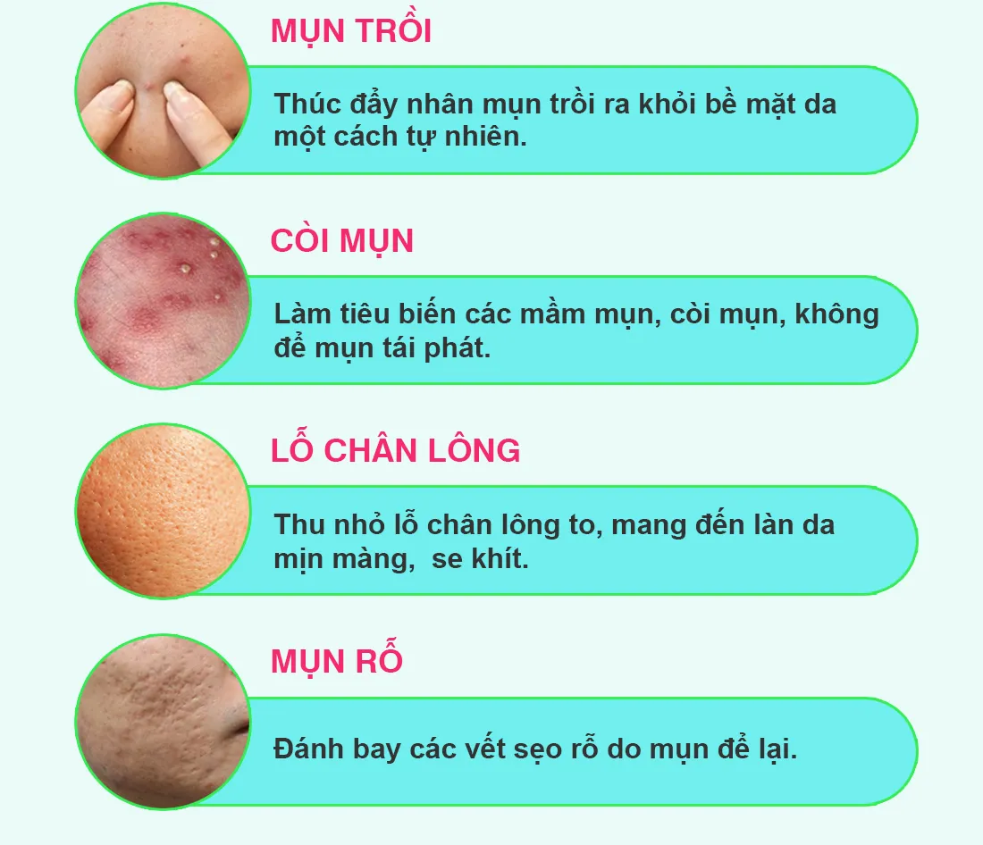 vien uong tri mun biosotrex 3