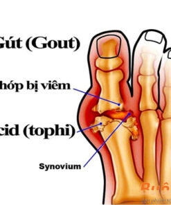 viên uống đặc trị bệnh gout feburic tablet 10mg có tốt không