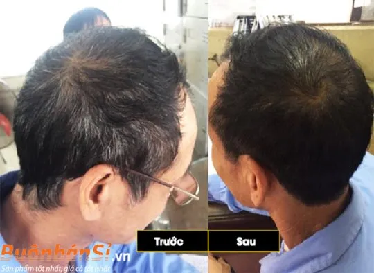 anti-gray hair 7050 mỹ 60 viên có tốt không