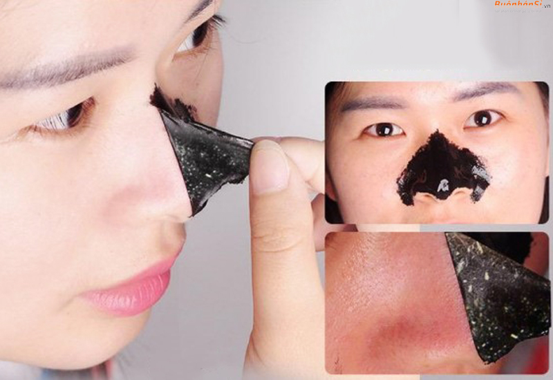 Cách loại bỏ đúng cách mụn đầu đen cứng đầu trên mũi 5 sử dụng miếng dán mụn