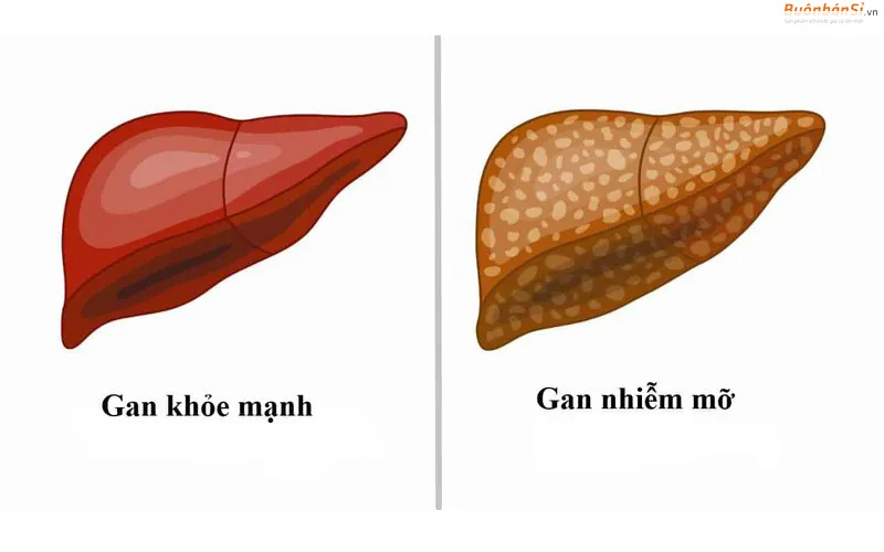 vitamin e cải thiện chức năng gan