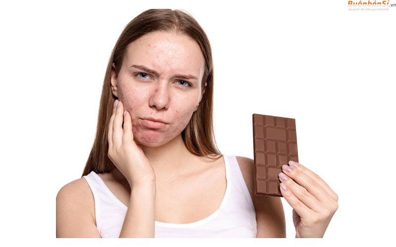 ăn socola không tốt cho da mụn